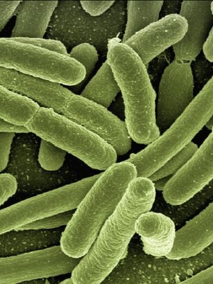 ** Analiza porównawcza: Mikroskopia świetlna vs. mikroskopia elektronowa w identyfikacji śladów biologicznych na nożach myśliwskich - 11 2025